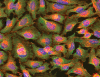 Image: Immunofluorescence cell staining using FGFR1 antibody (Photo courtesy of Abcam).